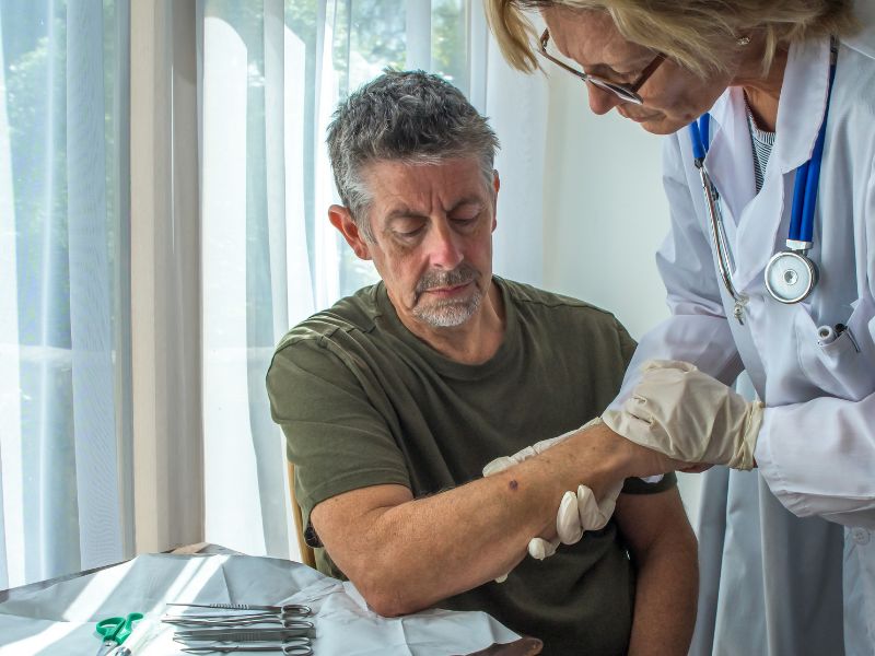 Dispensa de trabalhador com câncer de pele é discriminatória